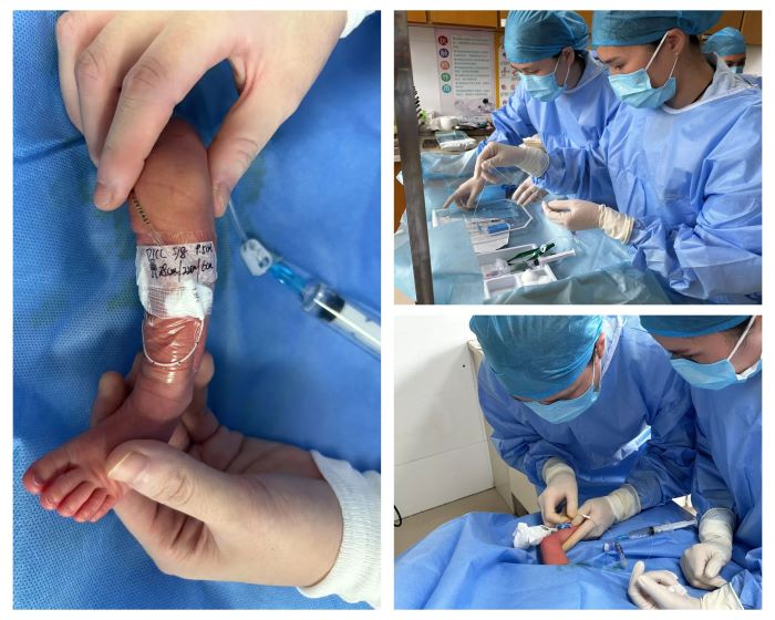 樟树市人民医院成功开展新生儿PICC置管技术 为危重新生儿搭建“生命营养通道”