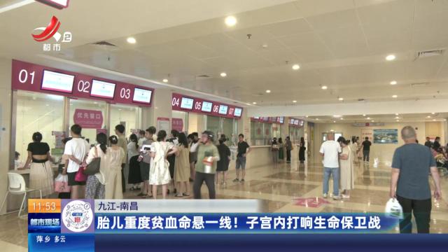 【九江-南昌】胎儿重度贫血命悬一线！ 子宫内打响生命保卫战