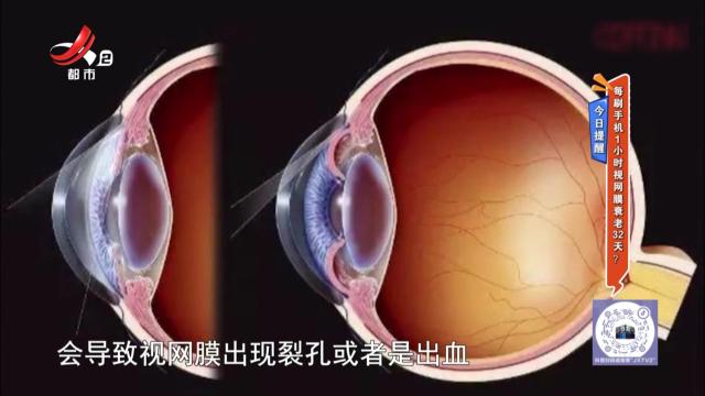 今日提醒：每刷手机1个小时视网膜衰老32天？