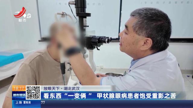【放眼天下】湖北武汉：看东西“一变俩” 甲状腺眼病患者饱受重影之苦