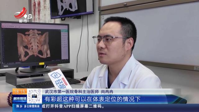 【放眼天下】湖北武汉：体温表在体内断裂 时隔22年彻底取出