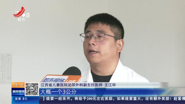 南昌：出生12天宝宝肾脏现肿瘤 医生“保肾拆弹”创纪录