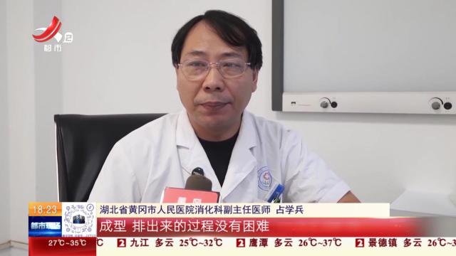【放眼天下·健康提醒】秋日便秘别乱用药 医生教您科学缓解方法