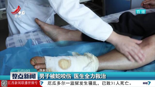 男子被蛇咬伤 医生全力救治
