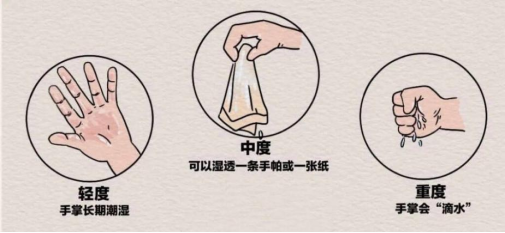 “水手”，拜拜！市三医院胸外科成功开展手汗症微创手术——胸腔镜下胸交感神经链切断术