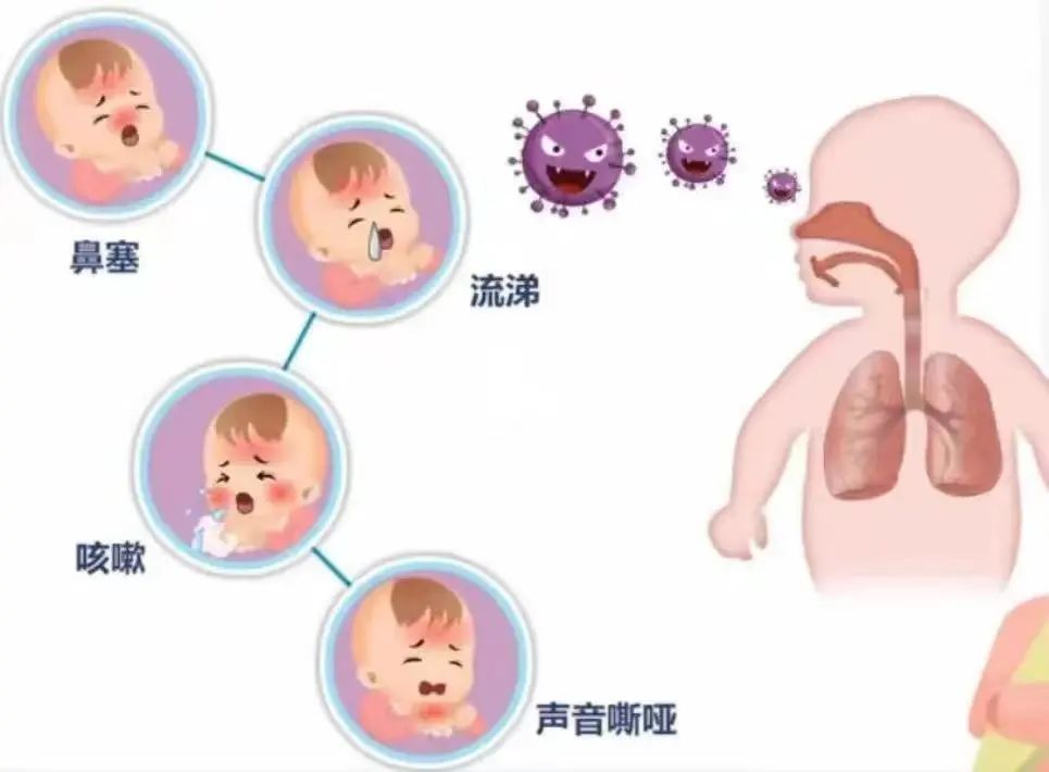 九江市妇幼保健院：支原体、衣原体……孩子呼吸道感染难辨病原？这种快速检验方法了解一下