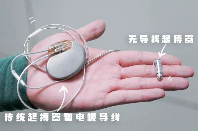 小“胶囊”解决心脏大问题！九江学院附属医院为八旬老翁重燃“心”希望