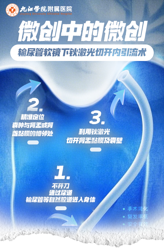 “微创中的微创” ——九江学院附属医院行多例输尿管软镜下钬激光切开内引流术