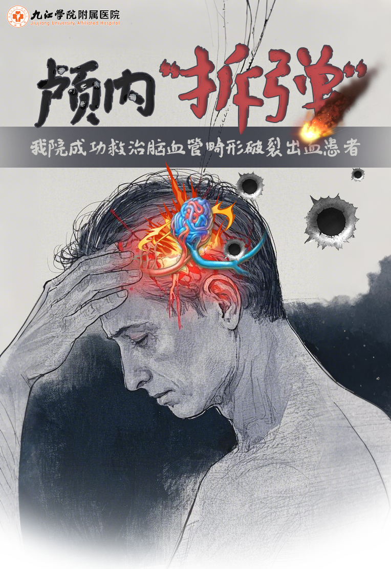 颅内“拆弹”！九江学院附属医院成功救治脑血管畸形破裂出血患者